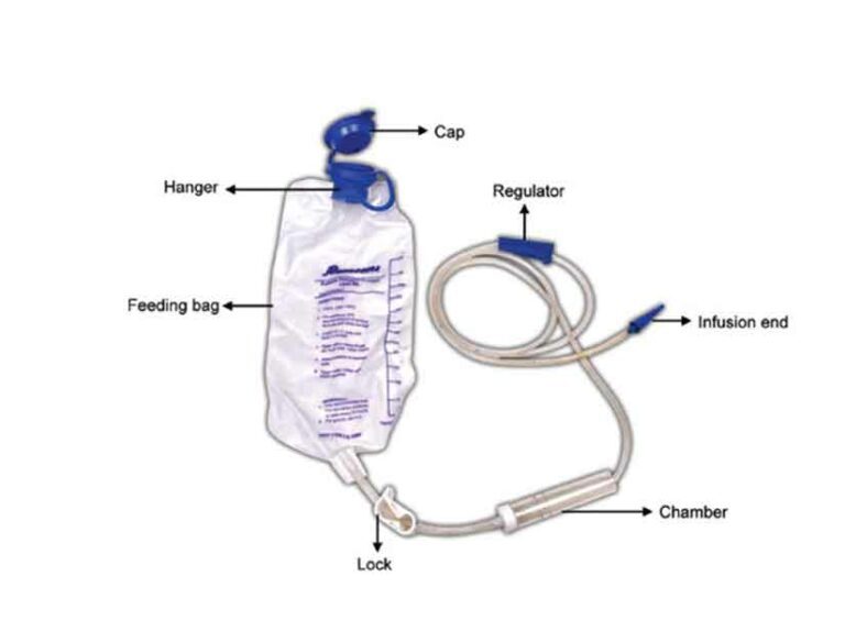 Medical Uses of Urine Bag (Urinary Drainage Bag)