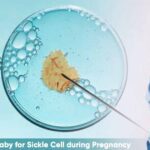 Couple can Test their Baby for Sickle Cell during Pregnancy