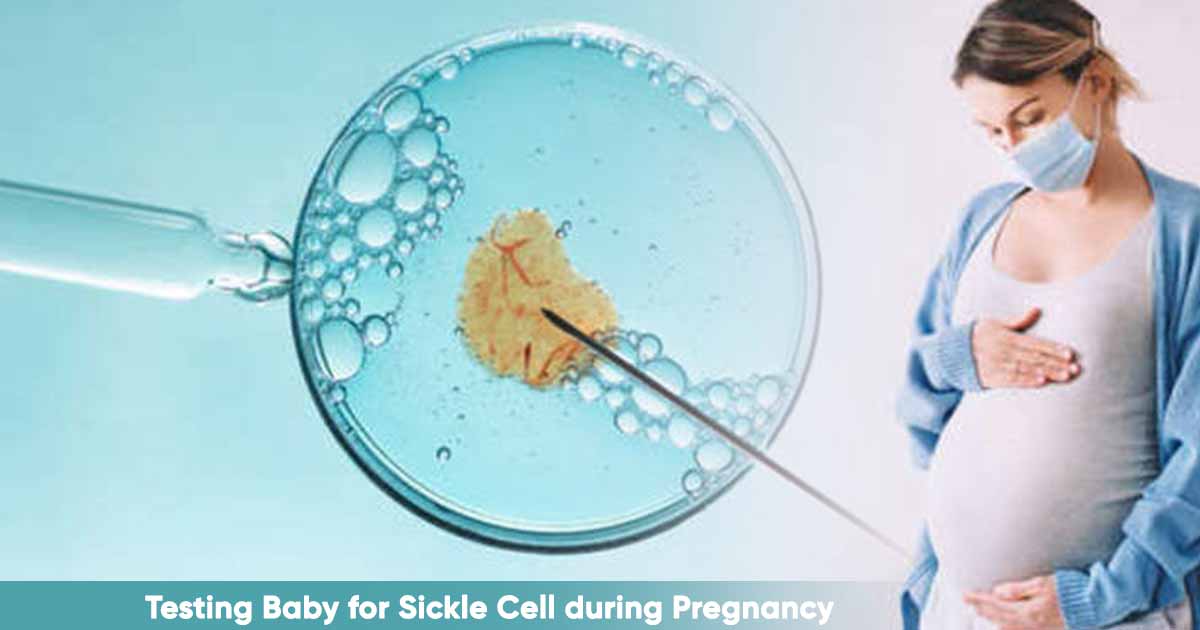 Couple can Test their Baby for Sickle Cell during Pregnancy