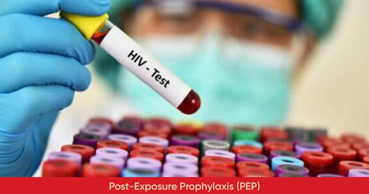 Post-Exposure Prophylaxis (PEP) in HIV