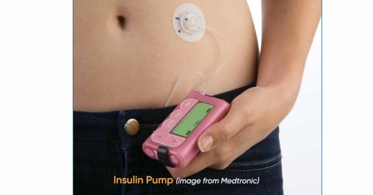 Insulin Injection Devices: Insulin Syringes, Pens, Pumps, Different ...