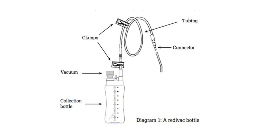 Redivac Drain: Important Uses, How to Change the Drain Parts of a Redivac Drain
