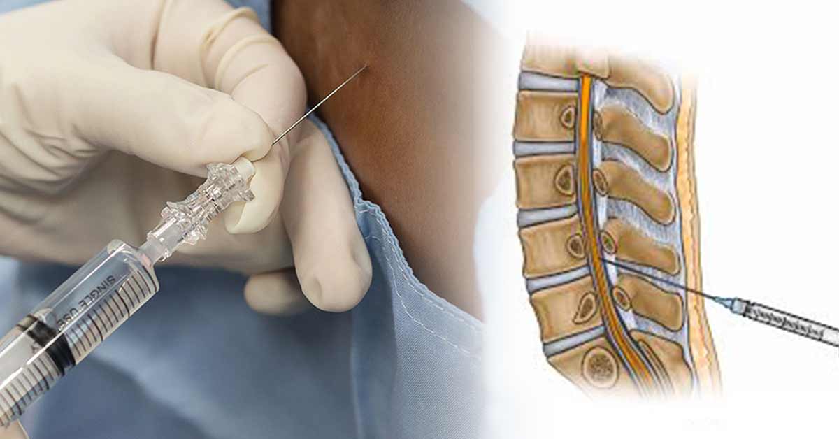 Types of Spinal Needles, and the Uses